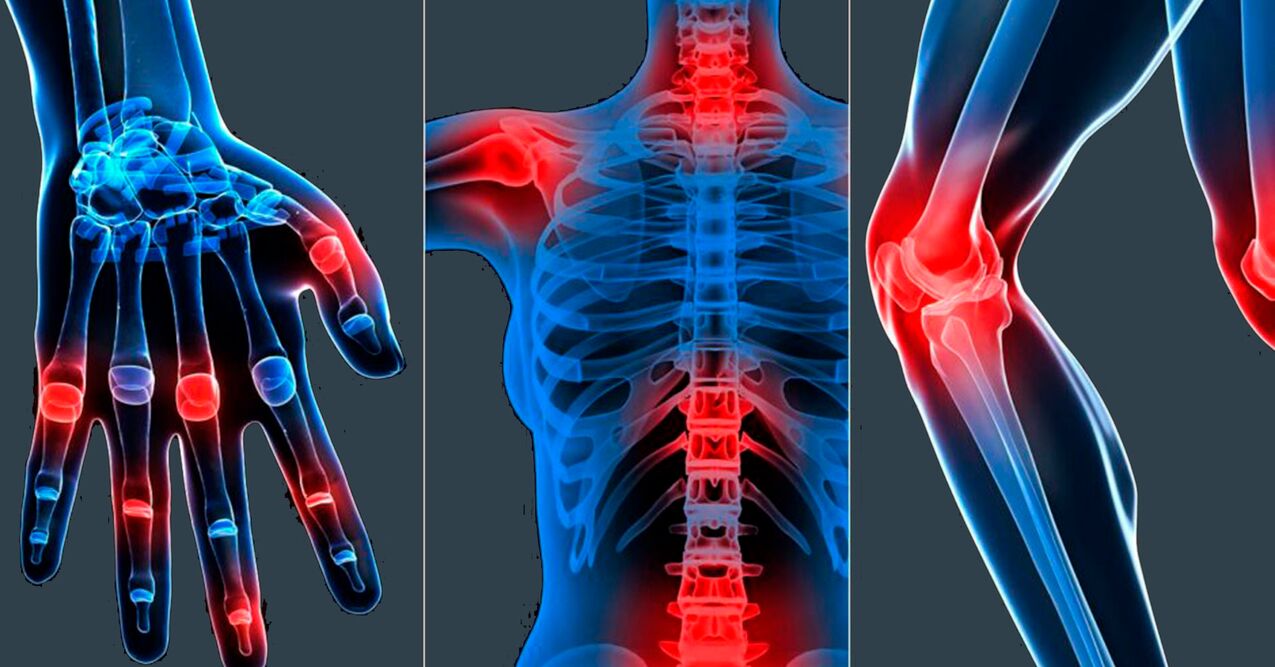 Οδηγίες χρήσης εκχυλίσματος boswellia σε κάψουλες
