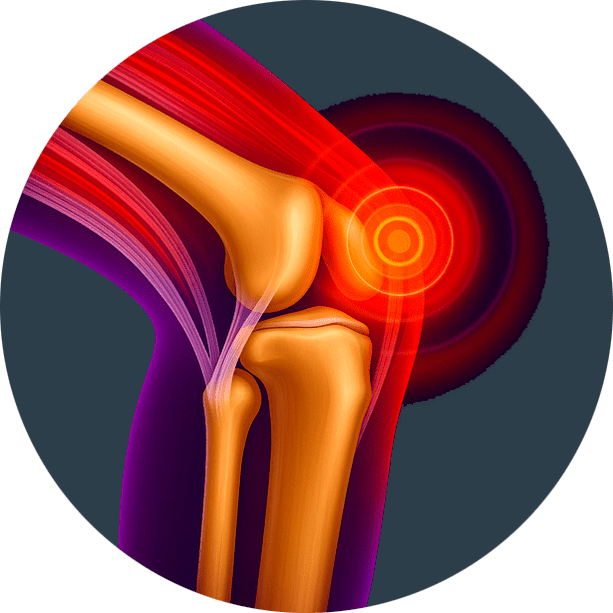 Φλεγμονή των αρθρώσεων